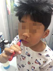 鼻血照片